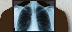 An X-ray of the lungs.