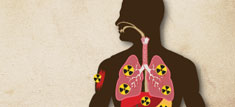 Radioactive material in different parts of the body.