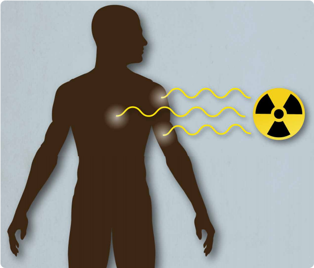 Graphic depicting a person being impacted by a radiation source