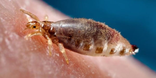 Photograph of a body louse on skin