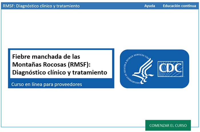 Fiebre manchada de las Montañas Rocosas (RMSF) Diagnóstico clínico y tratamiento