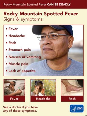 Poster: Rocky Mountain Spotted Fever can be deadly. RMSF signs and symptoms: Fever, Headache, Rash, Stomach pain, Nausea or vomiting, Muscle Pain, Lack of appetite. See a doctor if you have any of these symptoms