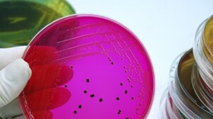 Petri dish of Salmonella