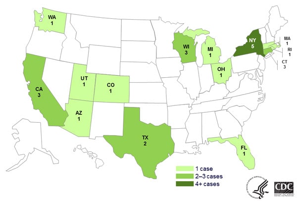 Persons infected with the outbreak strain of Salmonella Newport, Hartford, and Oranienburg by state, by state as of July 14, 2014