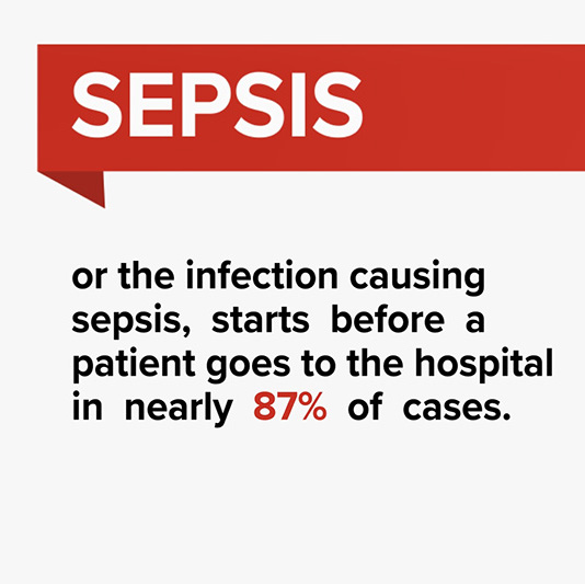 Sepsis or the infection causing sepsis