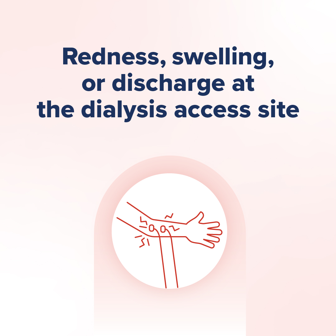 Sixth panel reads: “Redness, swelling, or discharge at the dialysis access site.” and shows pain in a dialysis access site in an arm.