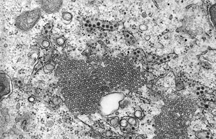 Transmission electron microscopic (TEM) image revealed the presence of numerous St. Louis encephalitis (SLE) virions