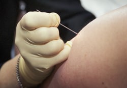 Medical personnel with gloved hand administering smallpox vaccine with a bifurcated needle