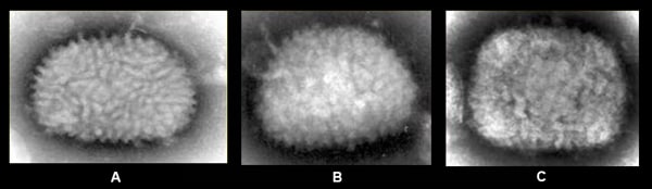 Figure 3:3-A: EM of vaccinia virus from tissue culture. 3-B: EM of vaccinia virus from clinical specimen. 3-C: EM of monkeypox virus from clinical specimen.