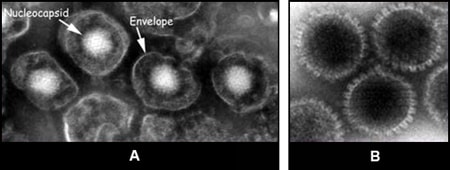 Figure 6:Two images of herpesvirus particles from tissue culture. 6-A: Enveloped virions. 6-B: Naked nucleocapsids, rimmed by hollow capsomers.