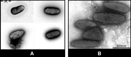 Figure 8: Two EM images of melanosomes