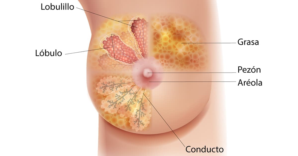 Qué es el cáncer de mama? | CDC