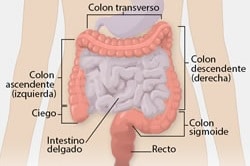 cancer de colon que lo provoca