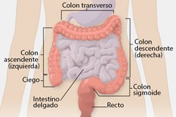 Ilustración médica del colon y el recto