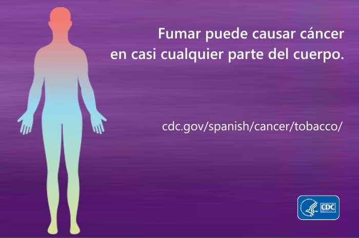 Fumar puede causar cáncer en casi cualquier parte del cuerpo. cdc.gov/spanish/cancer/tobacco/