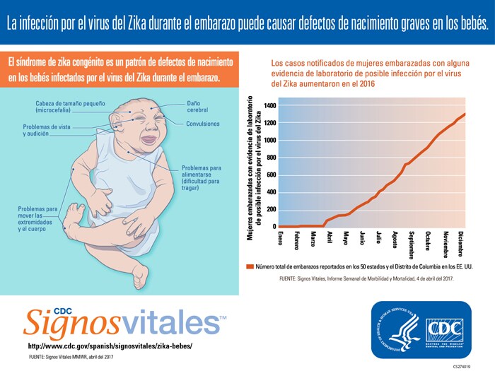 Infografía: La infección por el virus del Zika durante el embarazo puede causar defectos de nacimiento graves en los bebés.