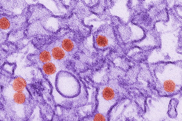 Esta es una micrografía tomada con microscopio electrónico de transmisión del virus del Zika, que pertenece a la familia de Flaviviridae. Las partículas del virus tienen un diámetro de 40 nm, con envoltura externa y un núcleo interno denso.