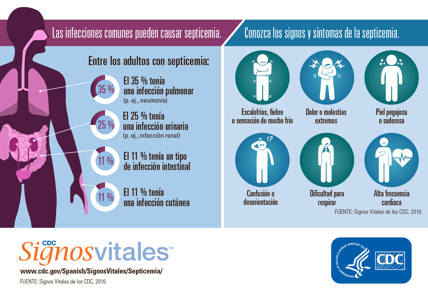 Sintomas de una hiperglucemia