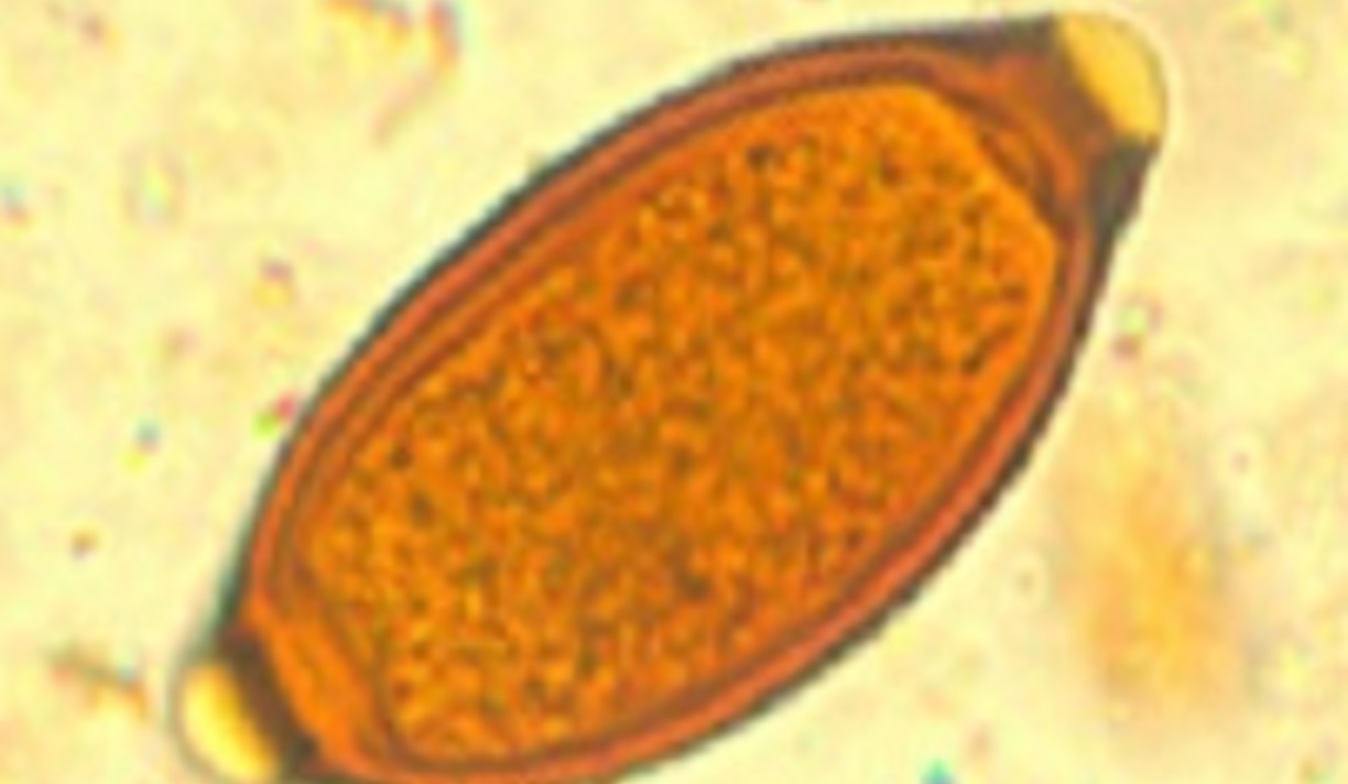 About Whipworms | Soil-Transmitted Helminths | CDC