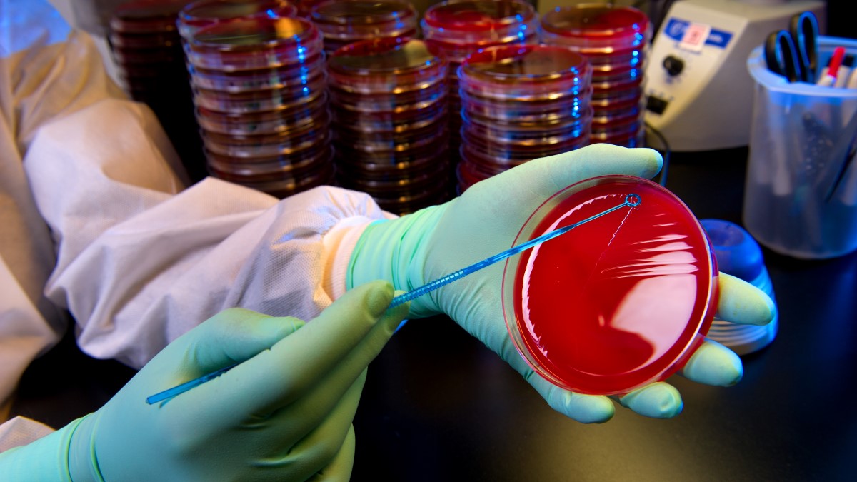 Streptococcus Laboratory | Strep Lab | CDC