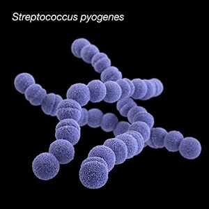 streptococcus pyogenes causes