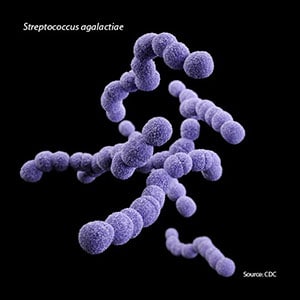 Streptococcus agalactiae (group B Streptococcus).