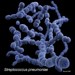 Streptococcus pneumoniae.