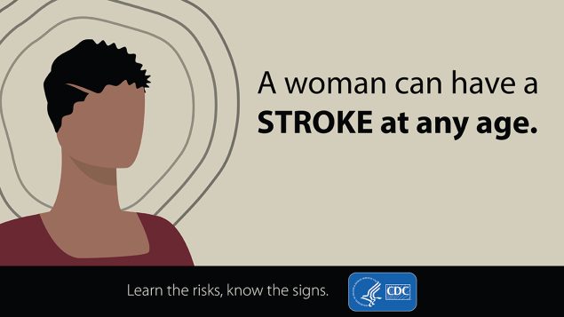 A woman can have a stroke at any age.