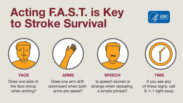 FAST-Graphic Acting F.A.S.T. is key to stroke survival.
