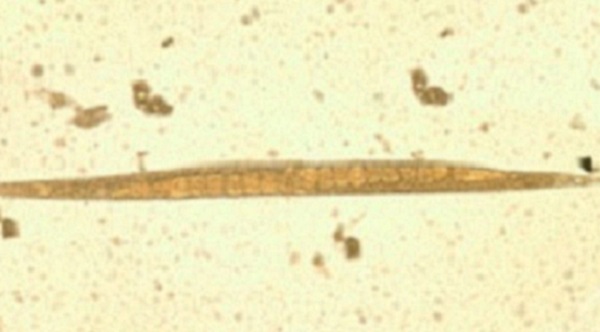 About Strongyloides | Strongyloides | CDC