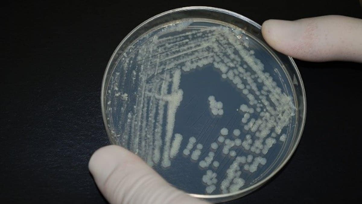 Bacteria grow in a petri dish