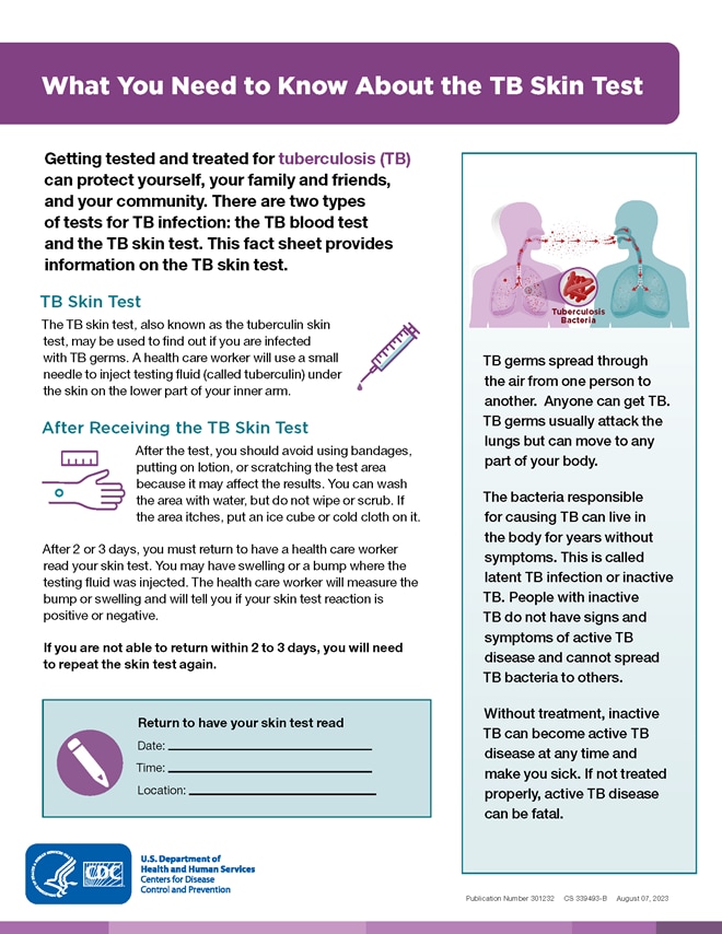 What you need to know about the TB skin test fact sheet