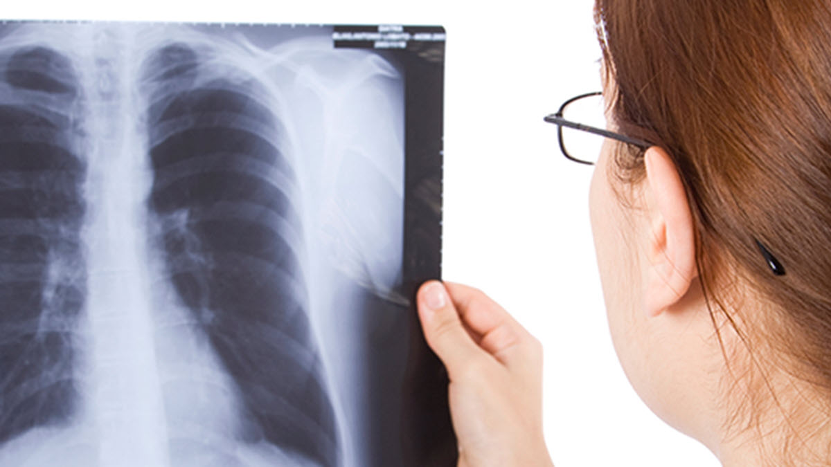 Diagnosing Tuberculosis | Tuberculosis (TB) | CDC
