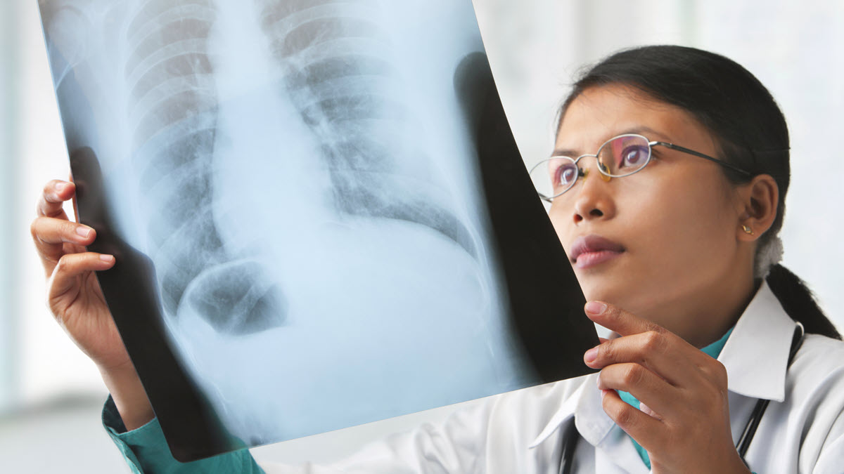 About Active Tuberculosis Disease | Tuberculosis (TB) About Active Tuberculosis Disease | Tuberculosis (TB)