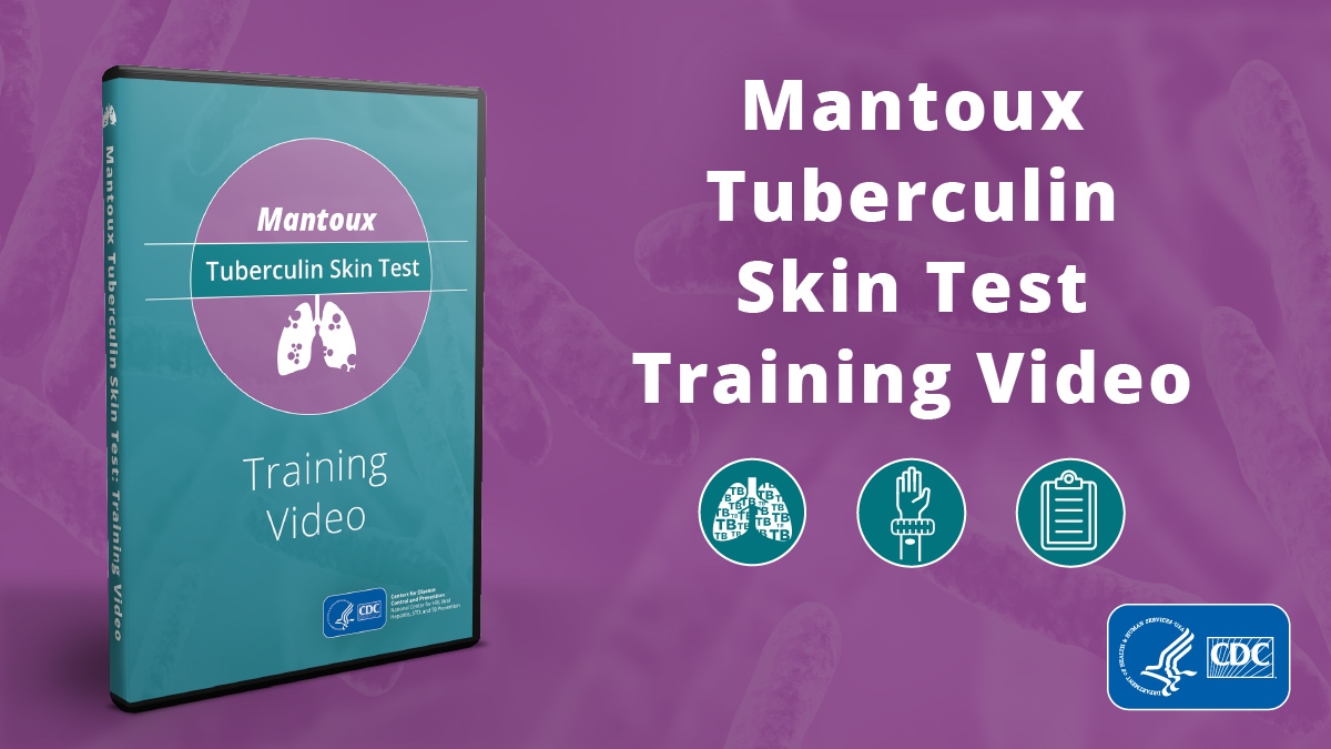 A Graphic of Mantoux Tuberculin Skin Testing DVD with an image of the DVD