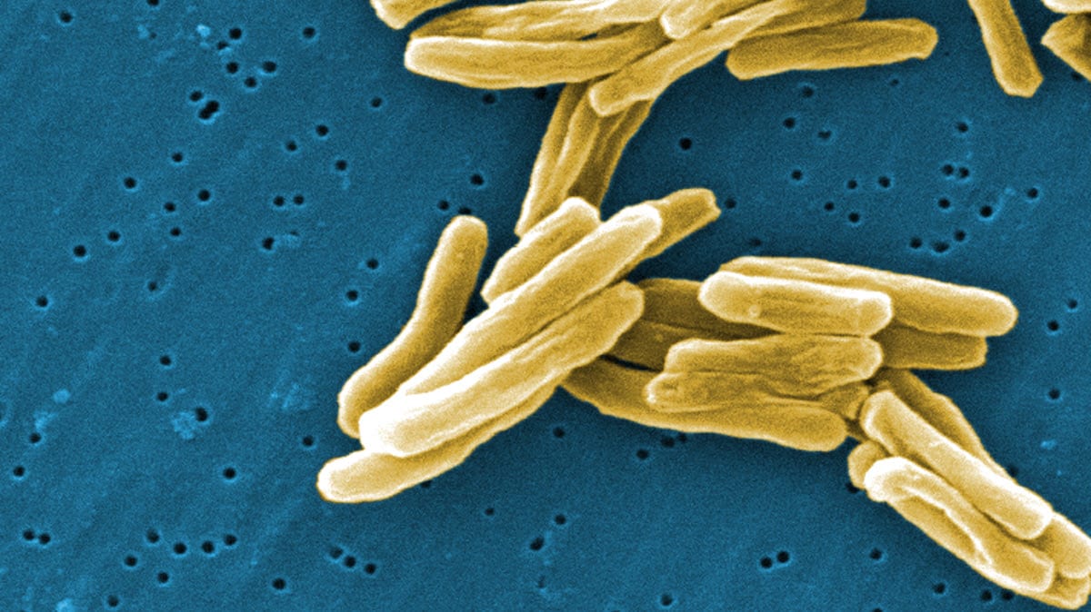 Under a high magnification of 15549x, this digitally-colorized, scanning electron microscopic (SEM) image depicted a number of Gram-positive, Mycobacterium tuberculosis bacteria.