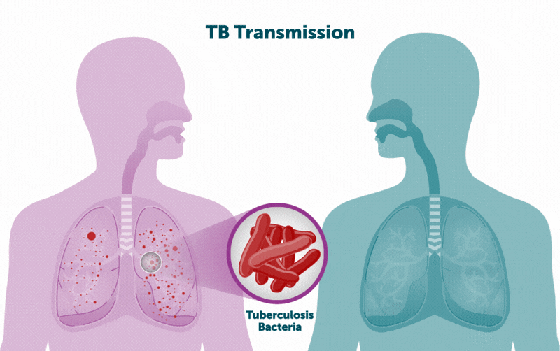 An animated graphic shows TB germs spreading from one person to another.