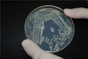 sample in petri dish
