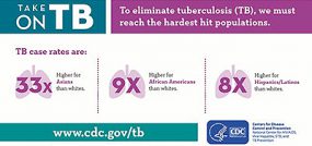 Take on TB
