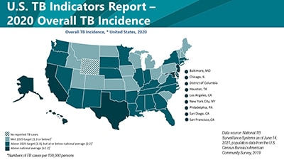 2020 State and City Tuberculosis Report