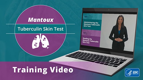Mantoux Skin Test