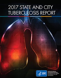 2017 State and City TB Report PDF file