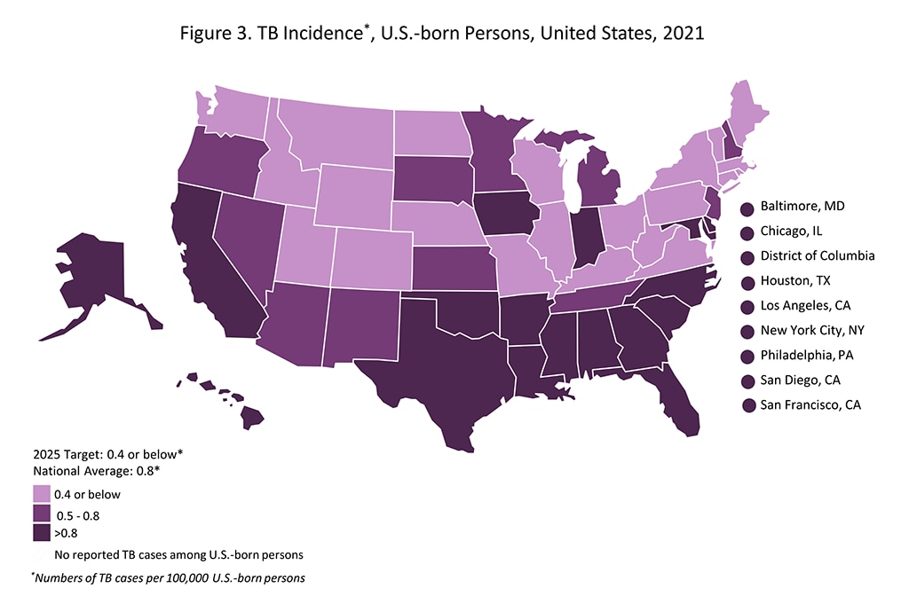 TB Incidence, U.S.-Born Persons, United States, 2021
