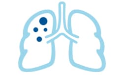 preventTB-lungs
