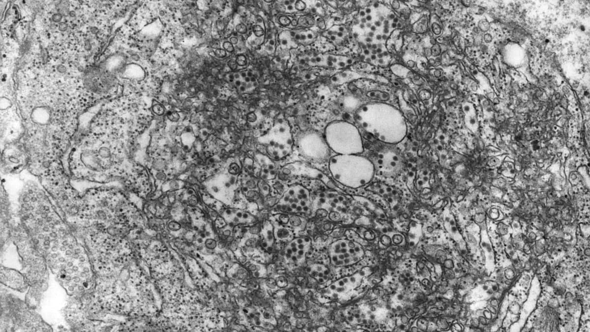 Transmission electron microscopic image of tick-borne encephalitis virus