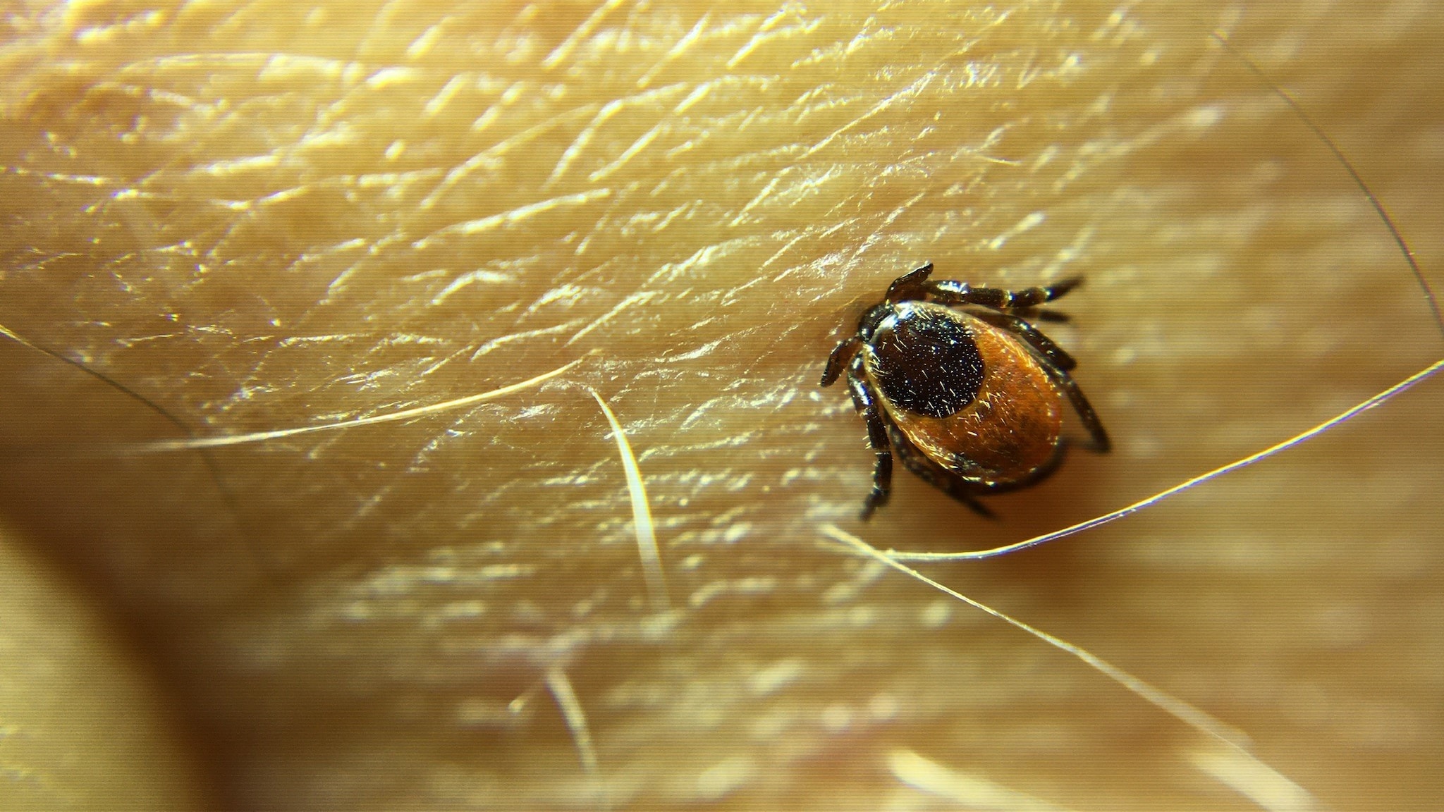 Blacklegged tick attached to skin