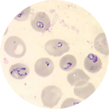 image of a blood smear showing Babesia parasites in red blood cells
