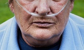 Man with tubes delivering oxygen through his nose