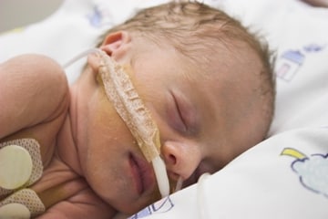 Baby in an incubator