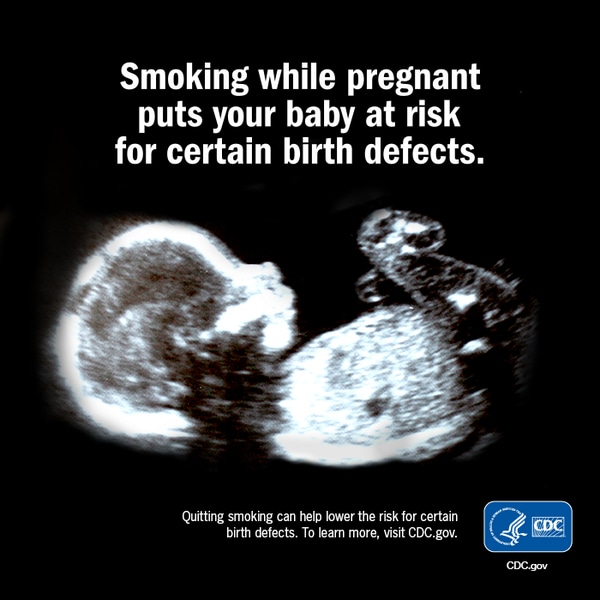Sonogram of fetus with the text: Smoking while pregnant puts your baby at risk for certain birth defects. Quitting smoking can help lower the risk for certain birth defects.